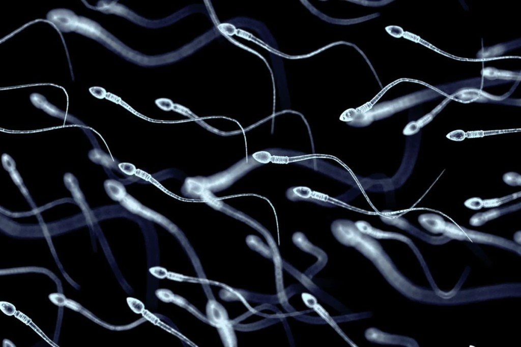 Sperm Counts Worldwide Have Plunged 62% In Under 50 Years, Study&nbsp;Finds
